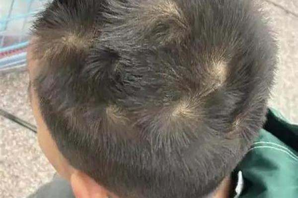 颠覆常识!三个头旋人命理背后的秘密 颠覆常识!三个头旋人命理背后的秘密