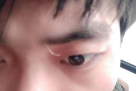 右眉出现白毛，命理中隐藏的深刻秘密