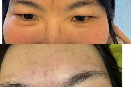 额头皱纹暗藏玄机，如何通过八字改变人生走向？